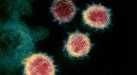 10 more Covid-19 cases reported in 24 hour